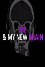 Watch Me & My New Brain FMoviesFree