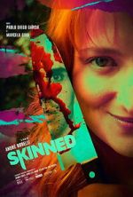 Watch Skinned FMoviesFree