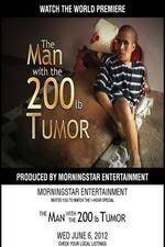Watch The Man With The 200lb Tumor FMoviesFree