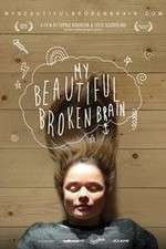 Watch My Beautiful Broken Brain FMoviesFree