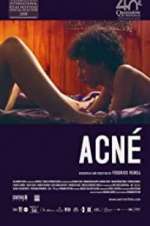 Watch Acné FMoviesFree