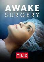Watch Awake Surgery FMoviesFree