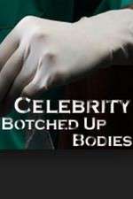 Watch Celebrity Botched Up Bodies FMoviesFree